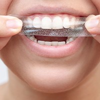 Closeup of someone placing whitening strip over top arch