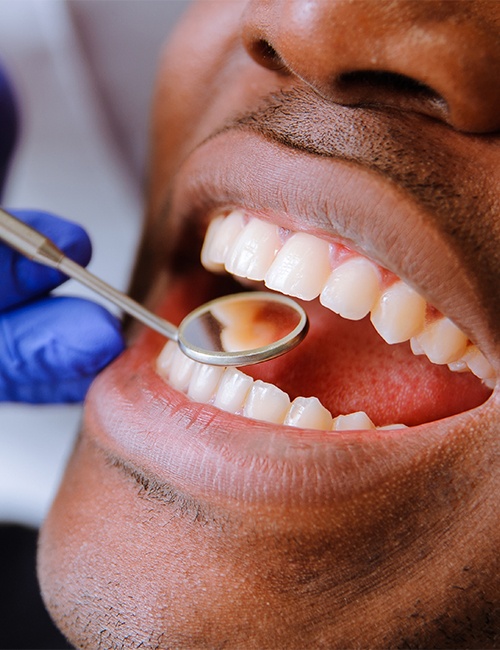 Dentist checking patient's tooth-colored fillings after restorative dentistry