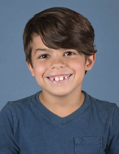 Child with healthy smile after fluoride treatment