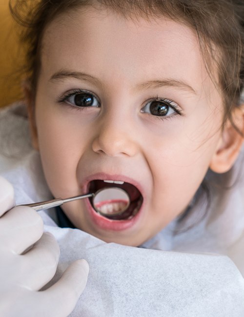 Dentist checking child's tooth colored fillings