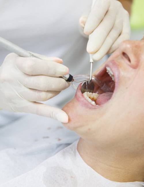 Dental patient undergoing a regular dental cleaning