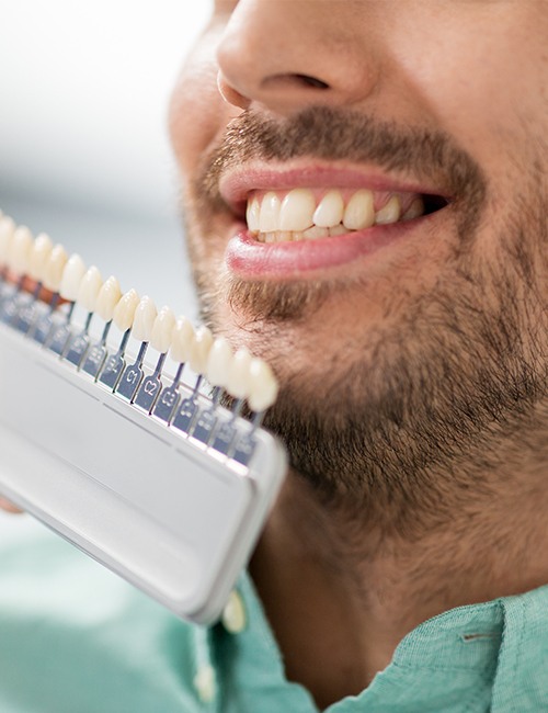 Man's smile compared with porcelain veneer shade chart during cosmetic dentistry consultation