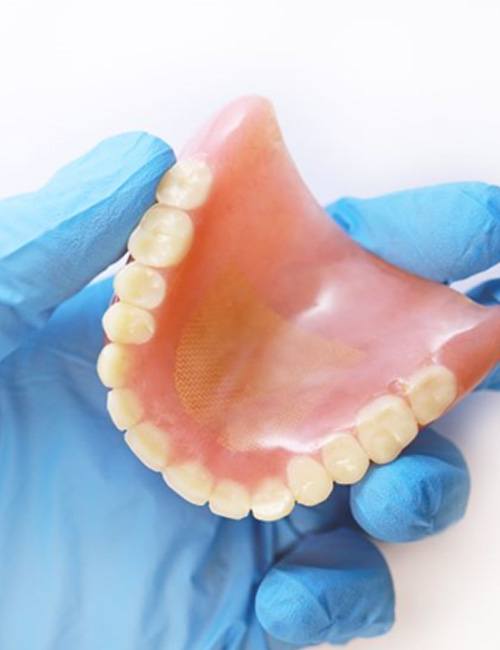 Gloved hand holding denture for upper arch