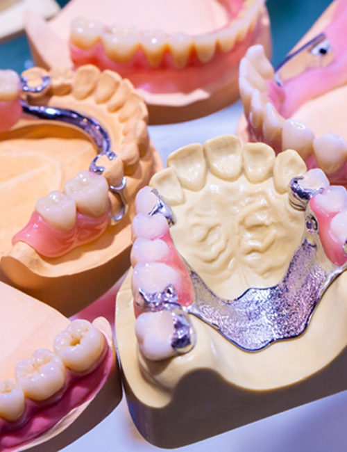 several dentures placed onto models of mouths