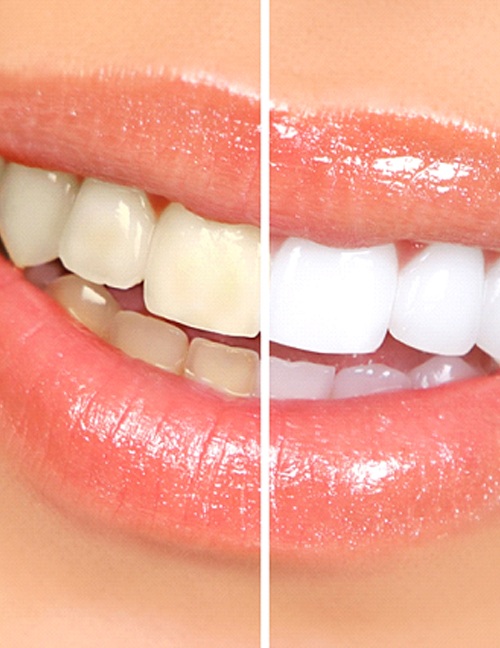 thumbnail interactive-video image 1 of Doctor's Choice Teeth Whitening Powder – Mint Flavored – 40g – Made In USA 1 of 6