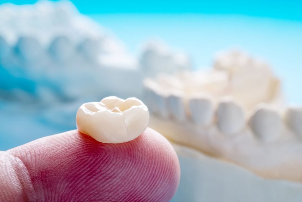 A dental crown sitting on a man’s fingertip.