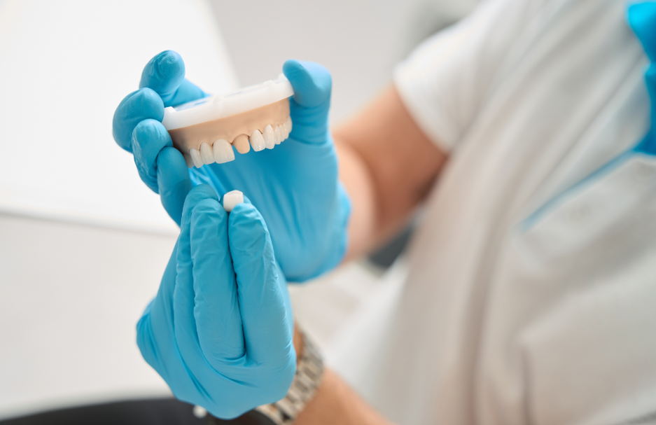 Dentist holding model dental crown
